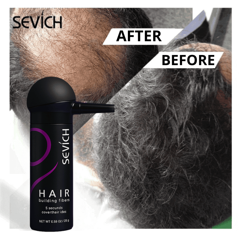Sevich Follics Hair Fibers™ - Anti-Hair Loss